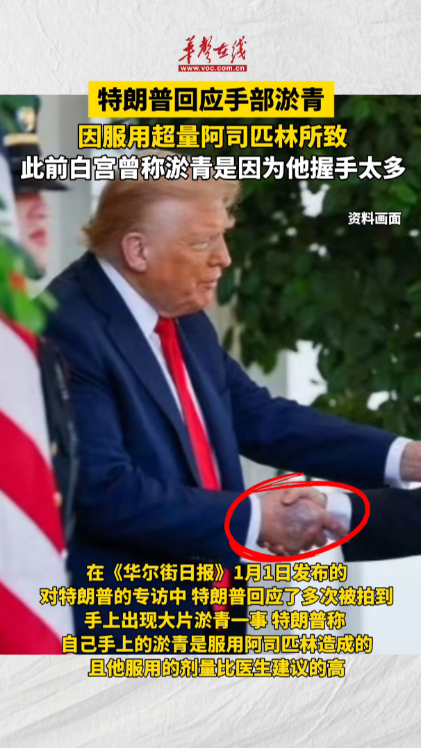 特朗普回應(yīng)手上淤青 因服用超量阿司匹林所致