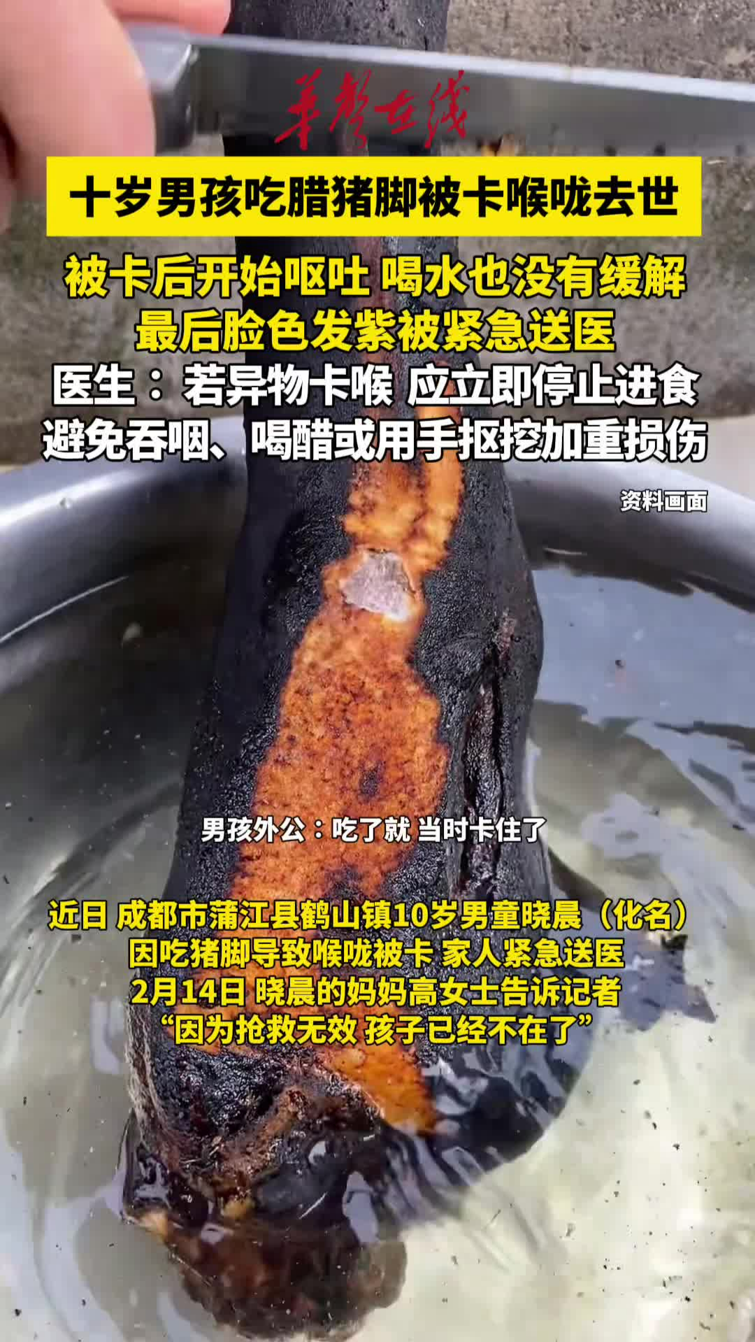 四川一男孩吃腊猪脚被卡喉咙去世