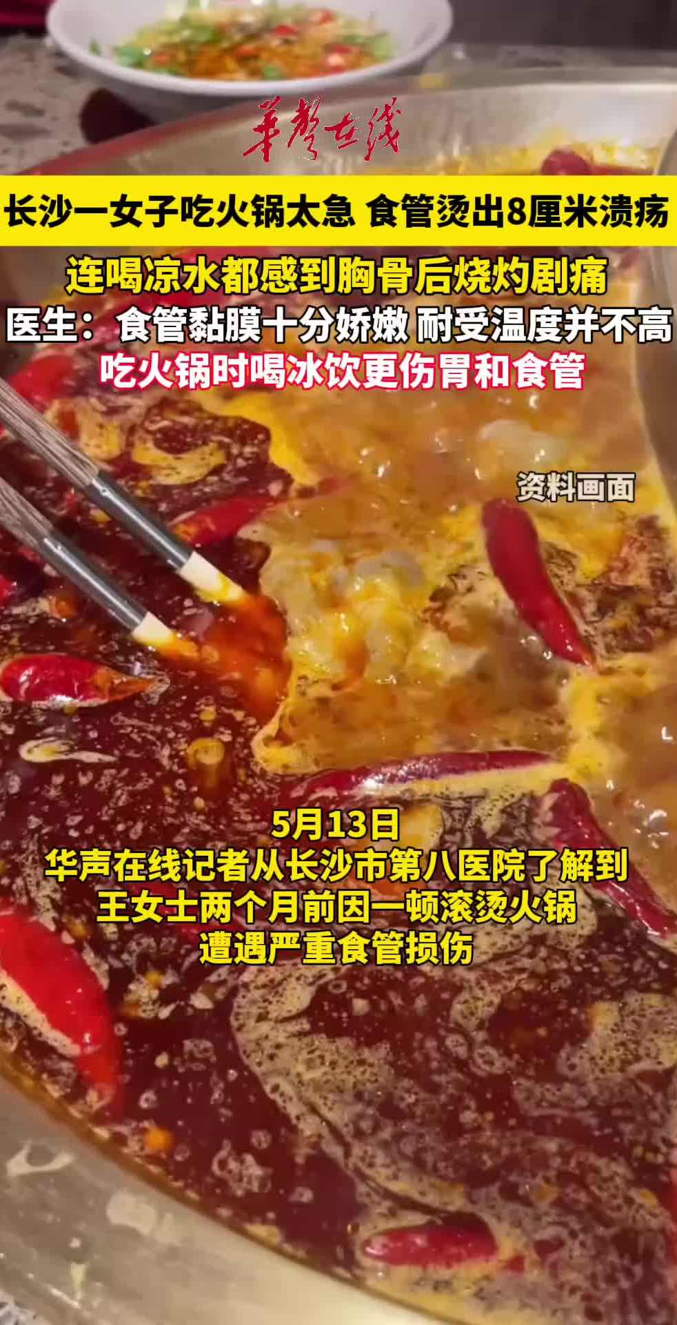 女子吃火锅太急食管烫出8厘米溃疡