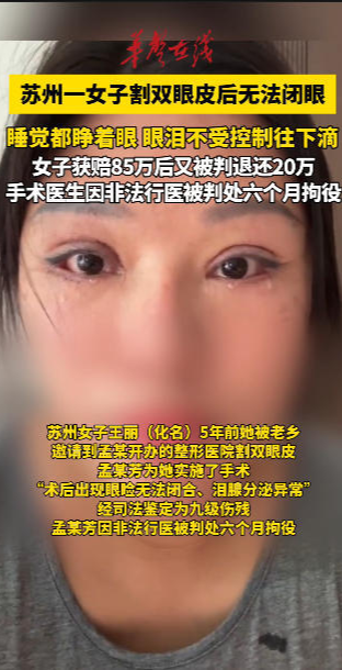 苏州一女子割双眼皮后无法闭眼